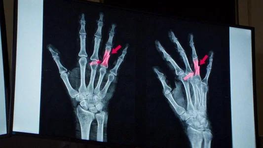 Foto de Anatomía de una Caída