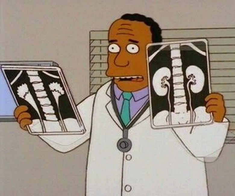 Homero Simpson en: Problemas renales